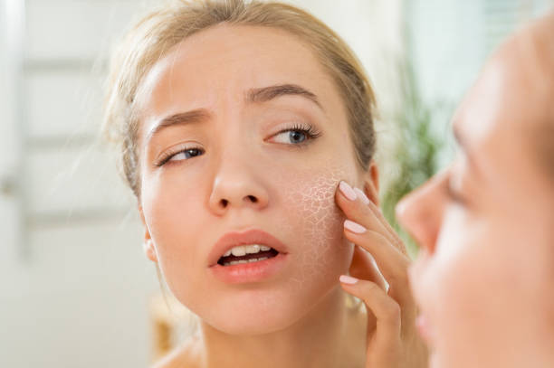 5 Effective Dry Skin Routine at home: Say Goodbye to Dry Skin